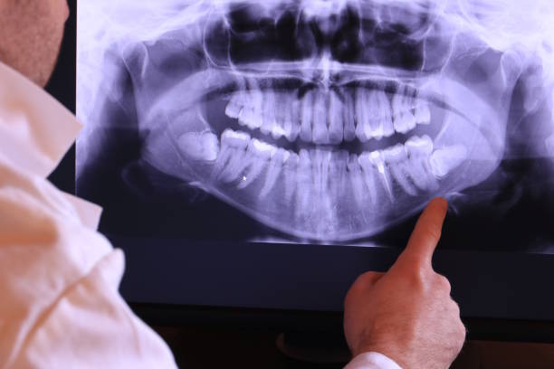 Best Cracked Tooth Emergency Dentist  in Del Monte Forest, CA