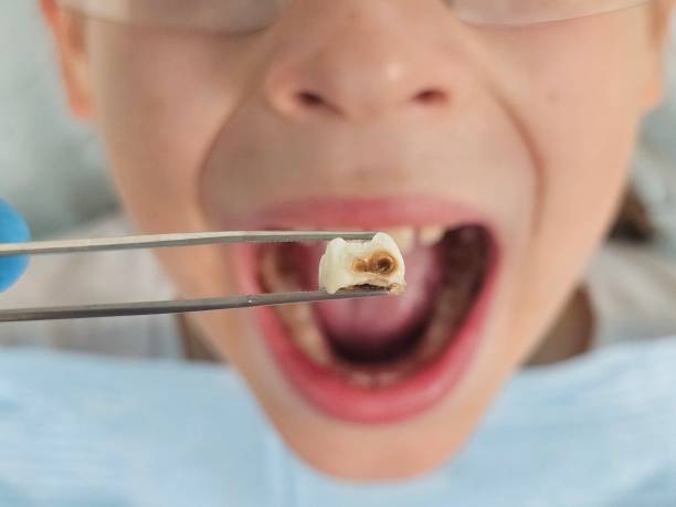 Best Emergency Pediatric Dentist  in Del Monte Forest, CA