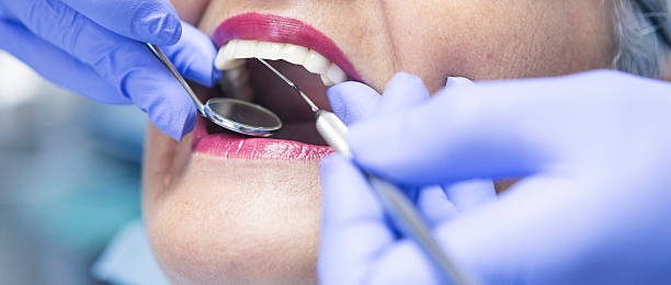 Best Cracked Tooth Emergency Dentist  in Del Monte Forest, CA